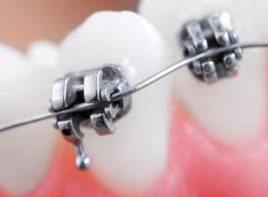 Roseville Aesthetic Dentistry