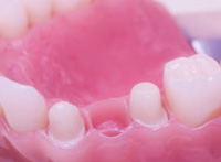 Roseville Aesthetic Dentist