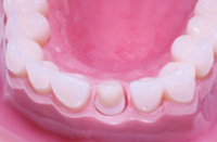 Roseville Esthetic Dentist