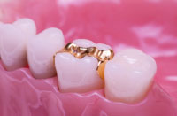 Roseville Cosmetic Dentist