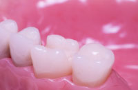 Roseville Aesthetic Dentist