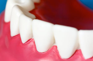 Roseville Periodontics