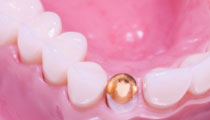 Citrus Heights Endodontics