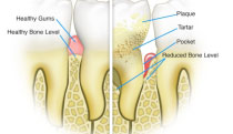 Roseville Periodontics