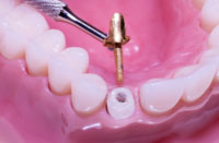 Roseville Endodontics