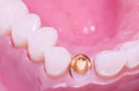Citrus Heights Endodontics