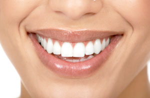Roseville Porcelain Veneers